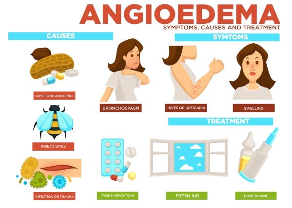 Atopic dermatitis