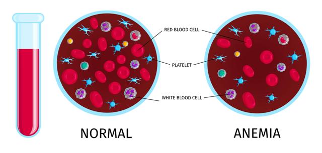 Hemoglobin count