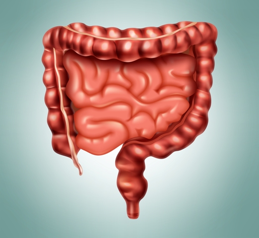 Diverticular disease