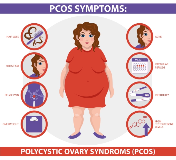 PCOS