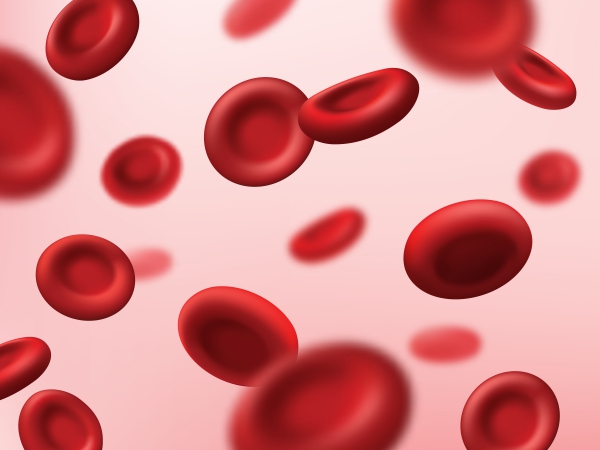 Sickle cell anemia