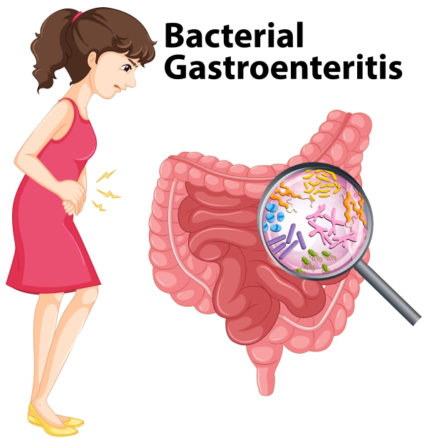 Bacterial gastroenteritis