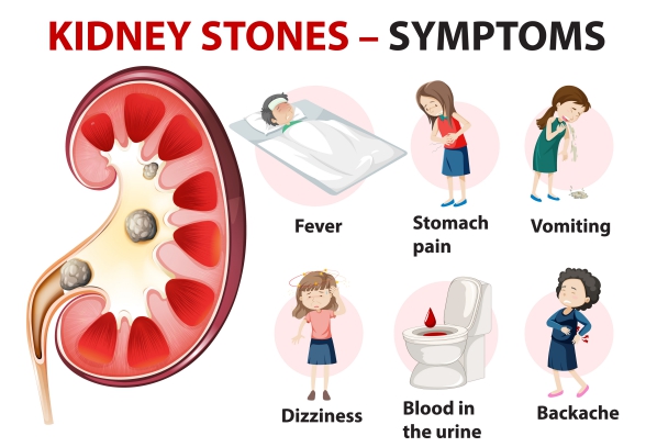 Nephrolithiasis