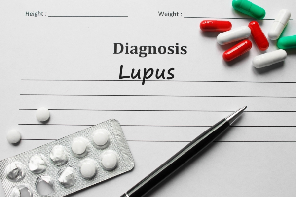 Systemic Lupus Erythematosus